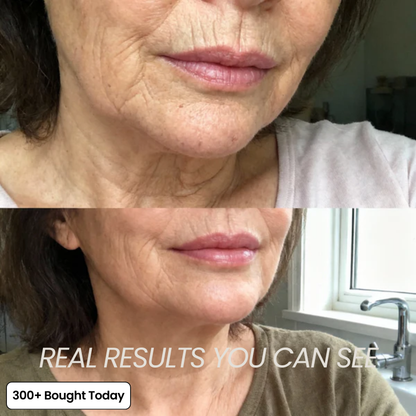 ⏰Last Day-Buy 1 Get 1 Free🔥 Calcium Multi Balm Eye Care Routine Korean Skin Care Anti-aging Cosmetics Collagen Eye Stick 9g